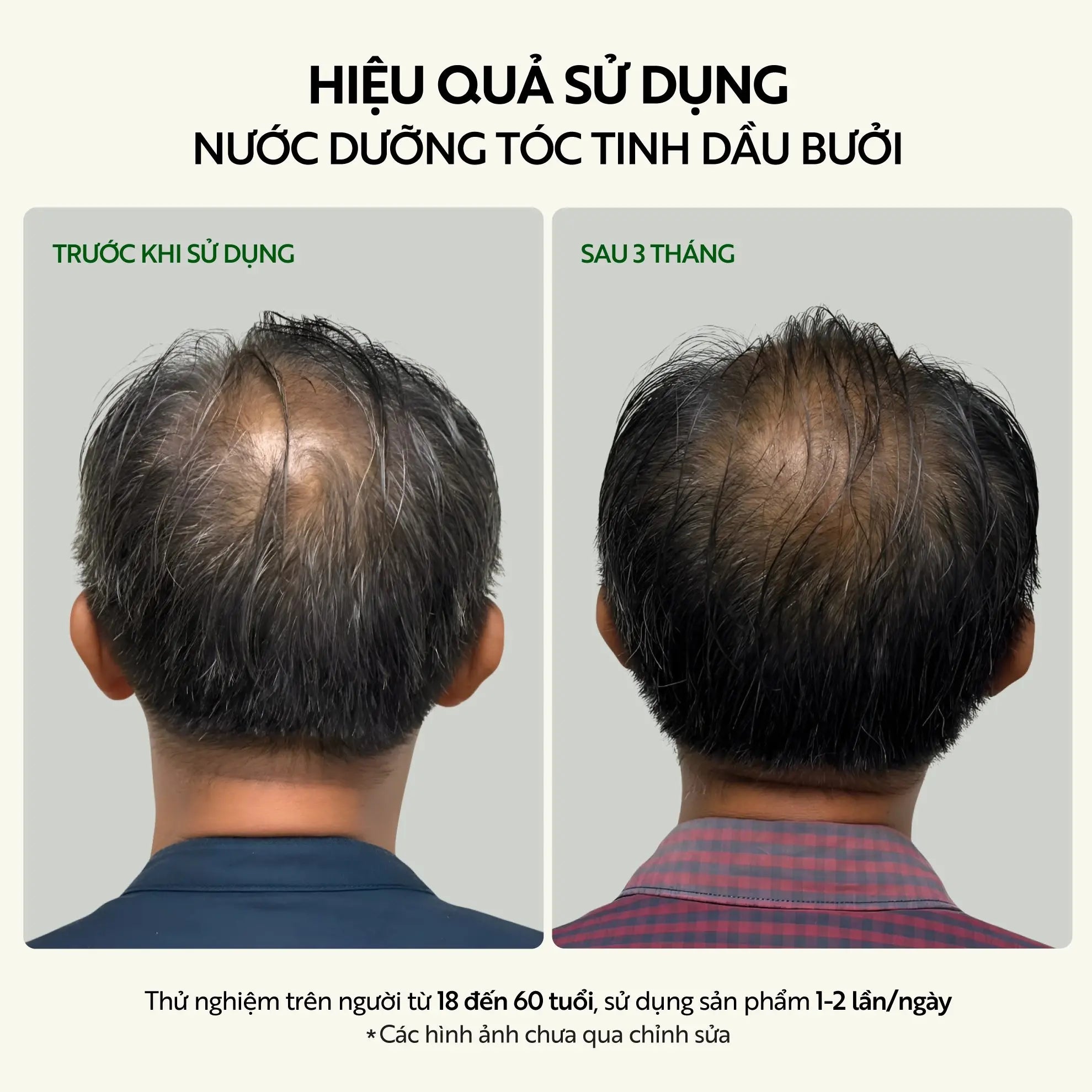 Bộ kích thích mọc tóc – Cocoon Hair Growth Set – 100% Vegan