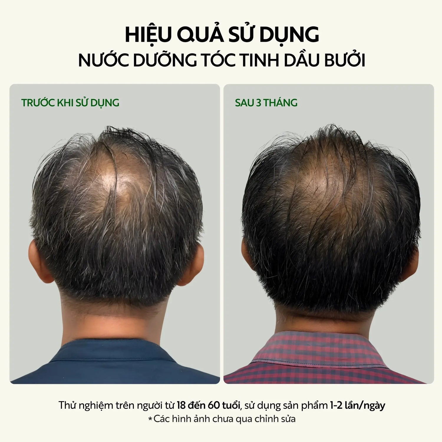 Bộ kích thích mọc tóc – Cocoon Hair Growth Set – 100% Vegan